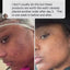Acne & Irritation Recovery Bundle